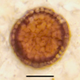 The difference in the cell types is visible under the microscope.